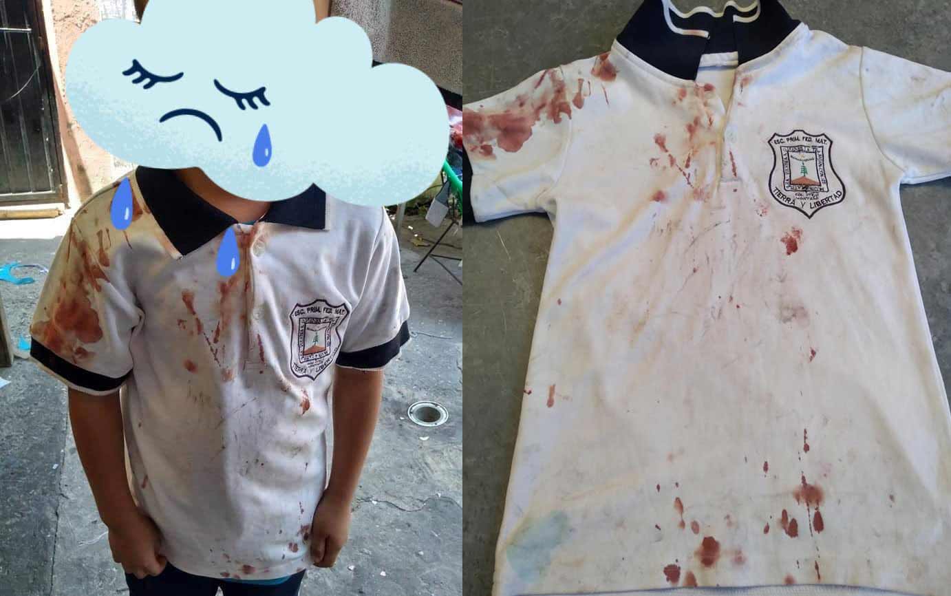 Niño de primaria en Morelos sufre bullying.